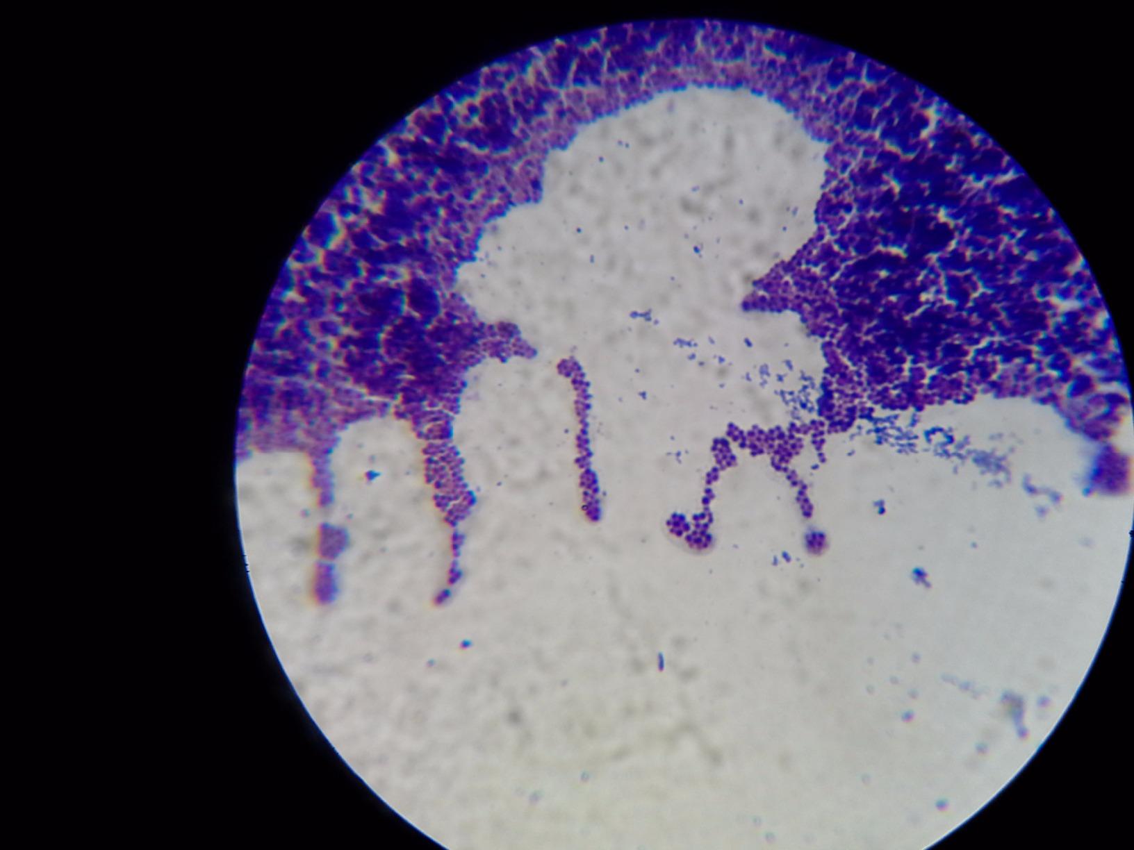 OMAX M82ES-SC100-LP100-OM 2000X LED Binocular Compound Lab Microscope customer photo 1