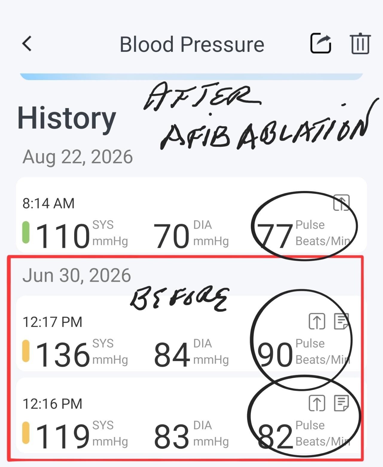 iHealth Track Smart Upper Arm Blood Pressure Monitor with Wide-Range Cuff customer photo 1
